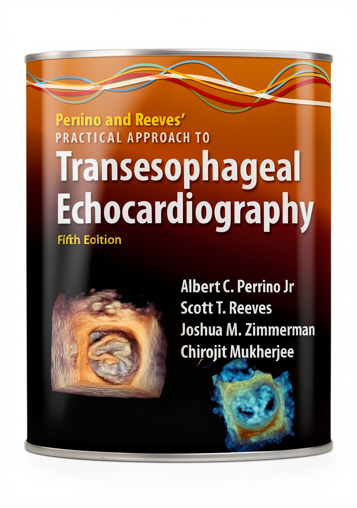 Anesthesiology eBook displayed on a Kindle device in a clinical setting