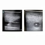 Kindle Store Anesthesiology Book English Edition-0